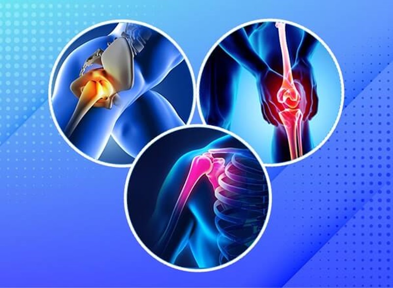 How to Choose the Best Arthroscopy Surgery Hospital in Delhi: Key Factors to Consider